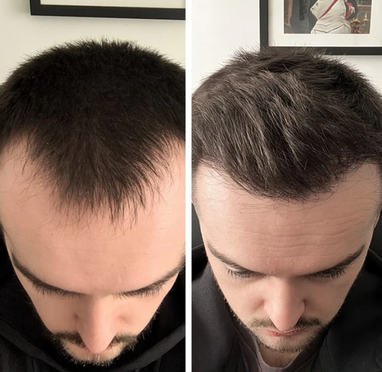 <p>Foto Reali Di Chi Lo Usa Davvero</p>