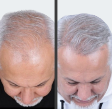 <p>Foto Reali Di Chi Lo Usa Davvero</p>